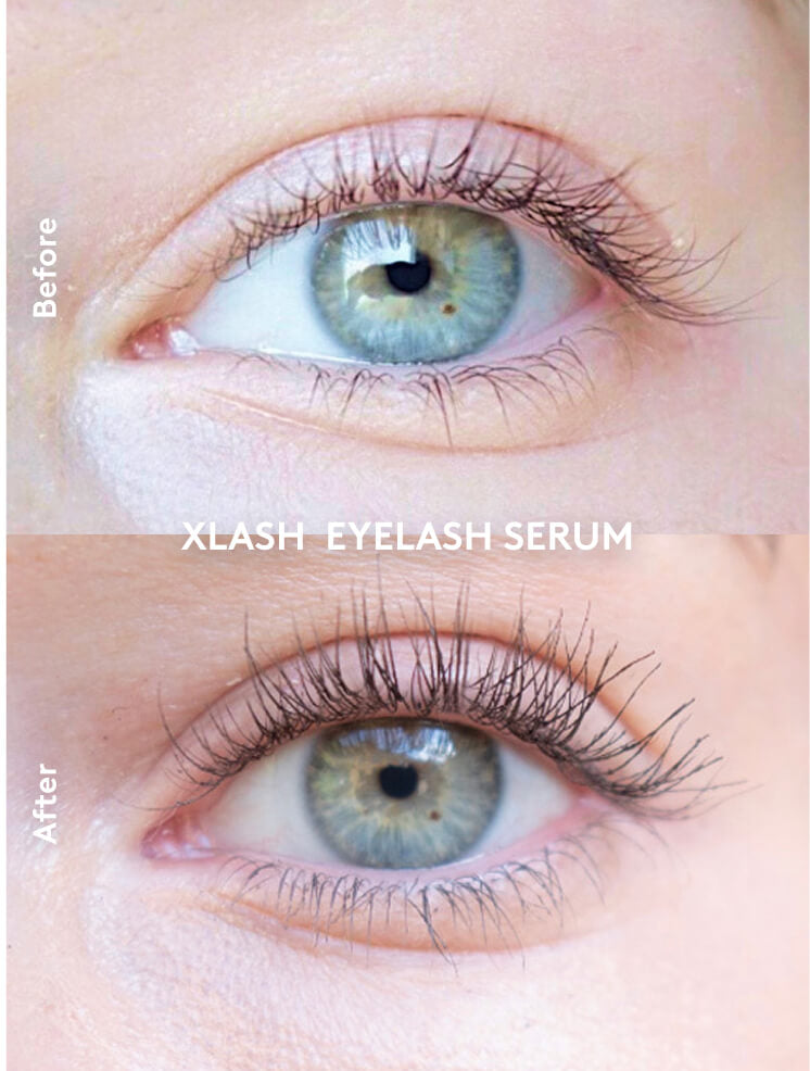 Xlash Skropstu Serums 1ml