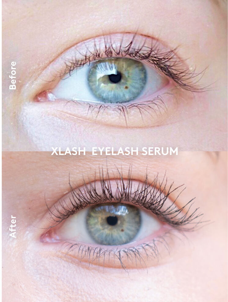 Xlash Skropstu Serums 5ml