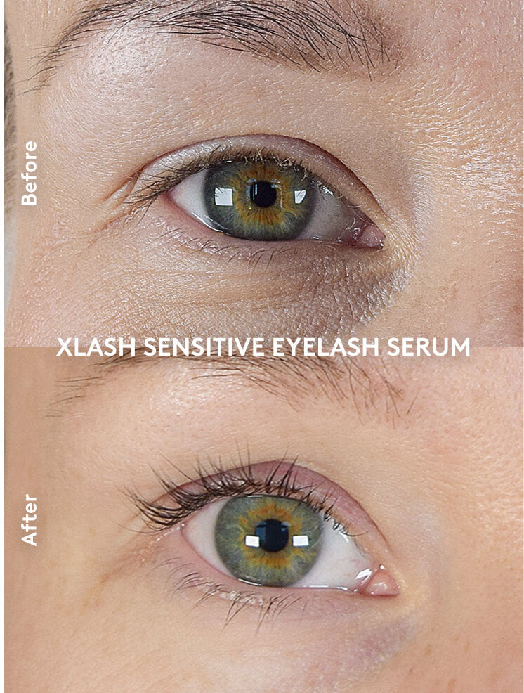 Xlash Skropstu serums jutīgām acīm 3ml